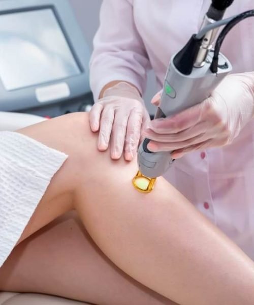laser-hair-removal-1.jpg